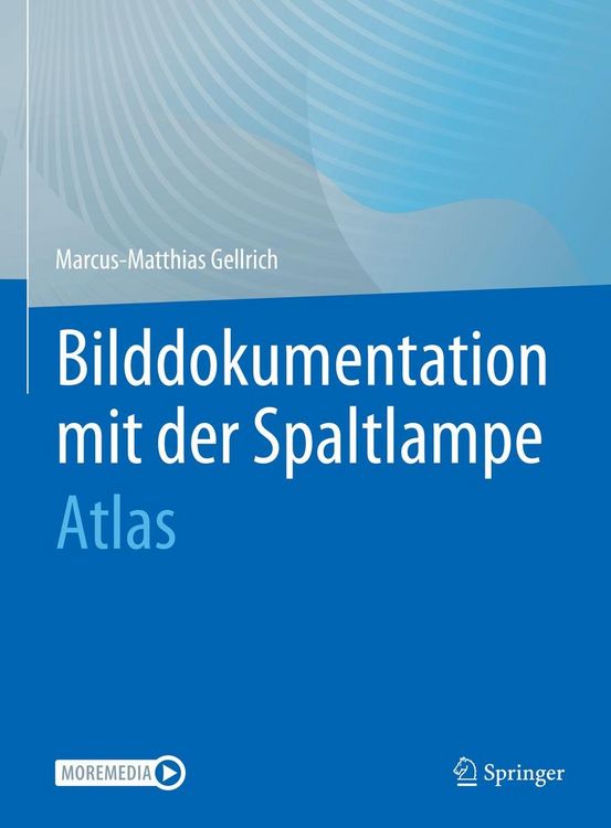 Produktbild: Bilddokumentation mit der Spaltlampe