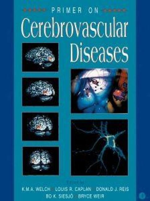 Produktbild: Primer on Cerebrovascular Diseases