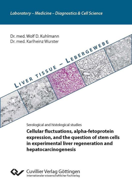Produktbild: Cellular fluctuations, alpha-fetoprotein expression, and the question of stem cells in experimental liver regeneration and hepatocarcinogenesis