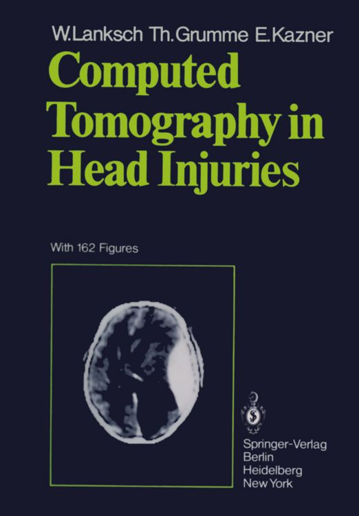 Produktbild: Computed Tomography in Head Injuries