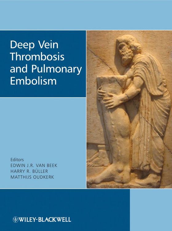 Produktbild: Deep Vein Thrombosis and Pulmonary Embolism
