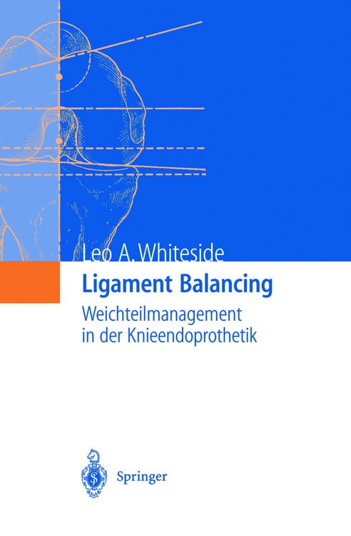 Produktbild: Ligament Balancing