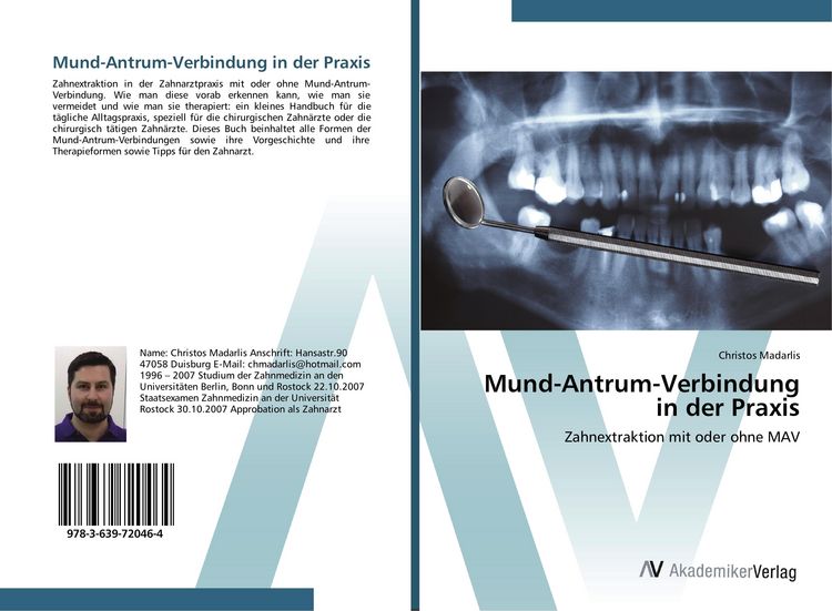 Produktbild: Mund-Antrum-Verbindung in der Praxis
