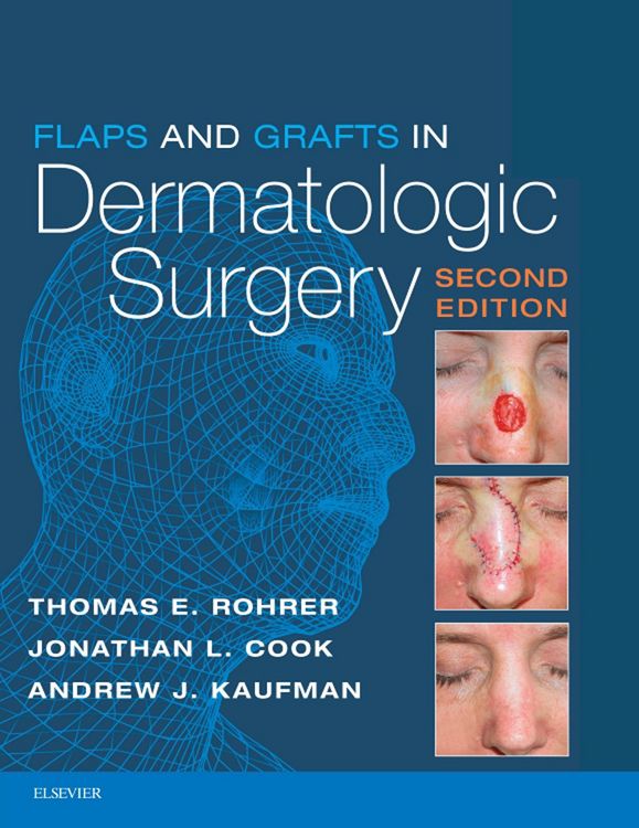 Produktbild: Flaps and Grafts in Dermatologic Surgery E-Book