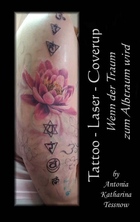 Produktbild: Tattoo - Laser - Cover Up