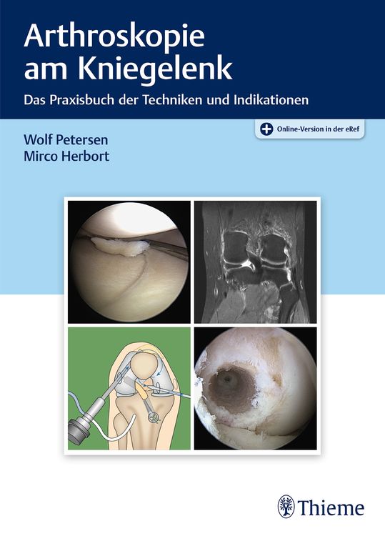 Produktbild: Arthroskopie am Kniegelenk