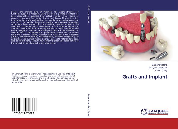 Produktbild: Grafts and Implant