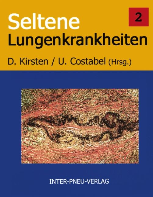 Produktbild: Seltene Lungenkrankheiten. Band 2