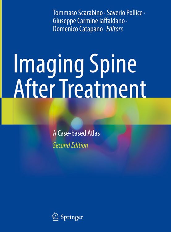 Produktbild: Imaging Spine After Treatment