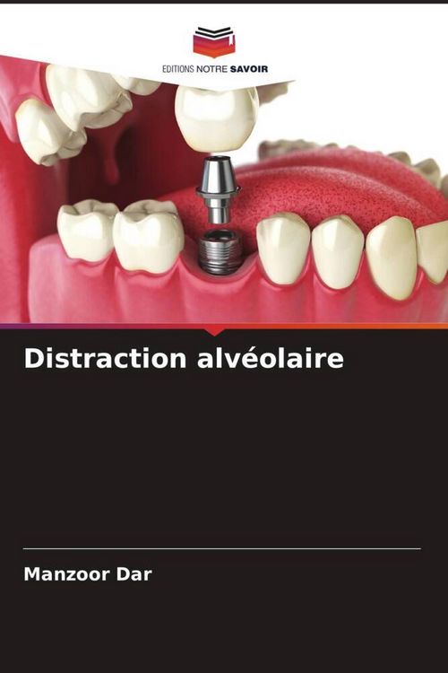 Produktbild: Distraction alv&eacute;olaire