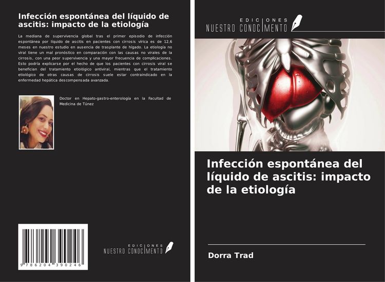 Produktbild: Infecci&oacute;n espont&aacute;nea del l&iacute;quido de ascitis: impacto de la etiolog&iacute;a