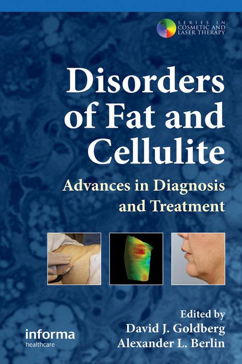 Produktbild: Disorders of Fat and Cellulite