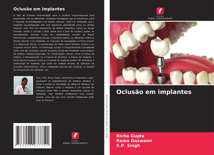Produktbild: Oclus&atilde;o em implantes