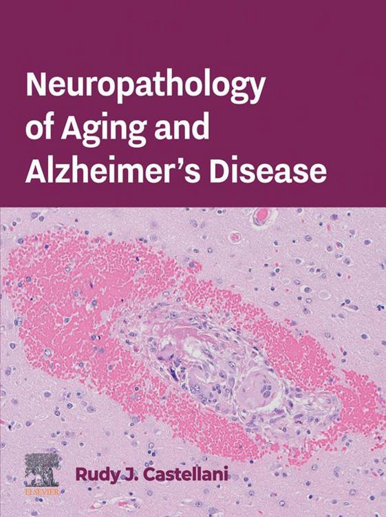 Produktbild: Neuropathology of Aging and Alzheimer's Disease