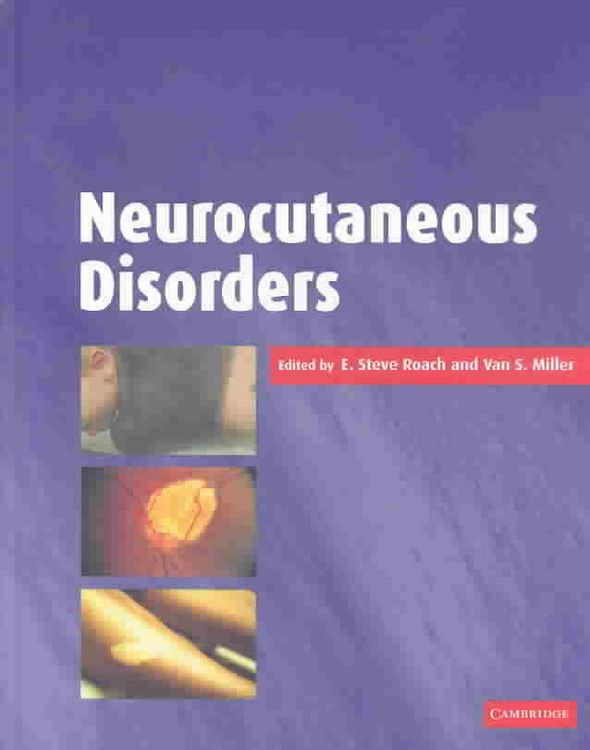 Produktbild: Neurocutaneous Disorders