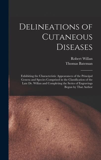 Produktbild: Delineations of Cutaneous Diseases: Exhibiting the Characteristic Appearances of the Principal Genera and Species Comprised in the Classification of t