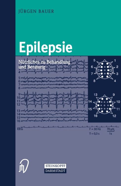 Produktbild: Epilepsie