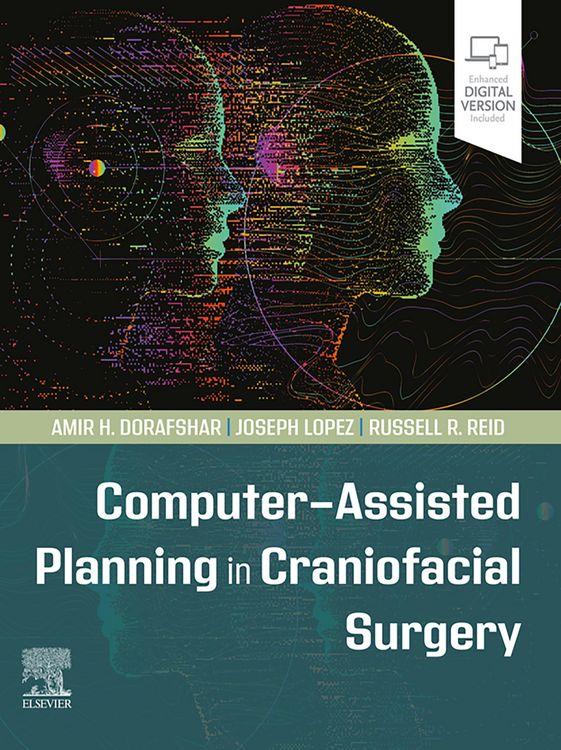 Produktbild: Computer-Assisted Planning in Craniofacial Surgery - E-Book