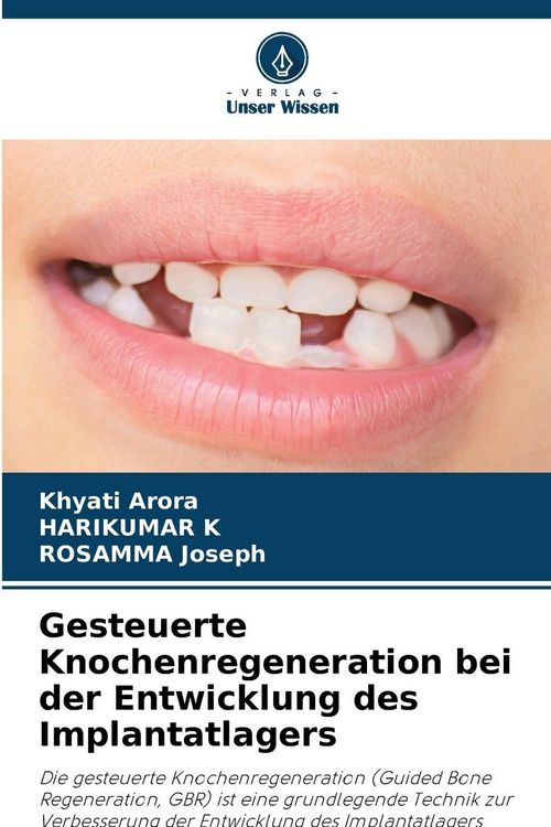 Produktbild: Gesteuerte Knochenregeneration bei der Entwicklung des Implantatlagers