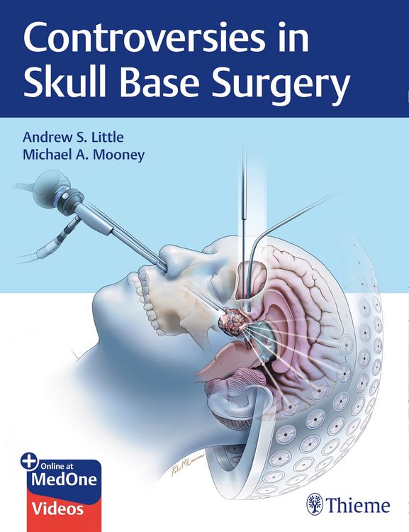 Produktbild: Controversies in Skull Base Surgery