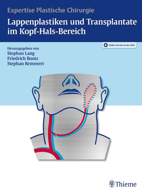 Produktbild: Lappenplastiken und Transplantate im Kopf-Hals-Bereich