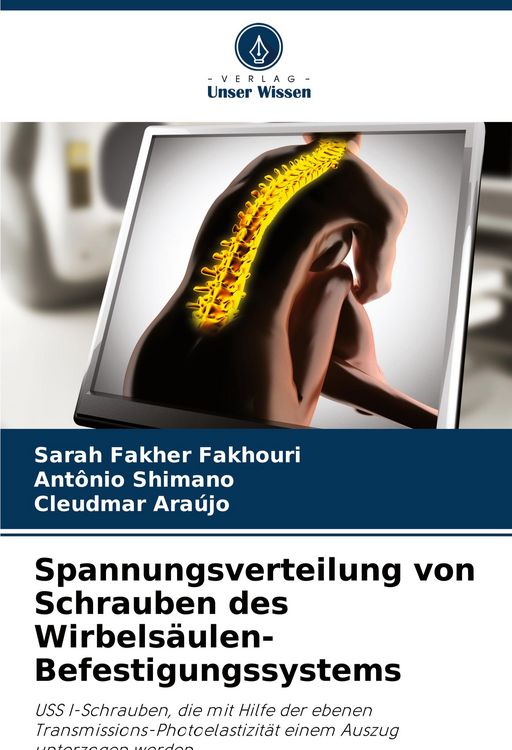 Produktbild: Spannungsverteilung von Schrauben des Wirbels&auml;ulen-Befestigungssystems
