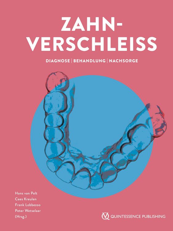 Produktbild: Zahnverschlei&szlig;