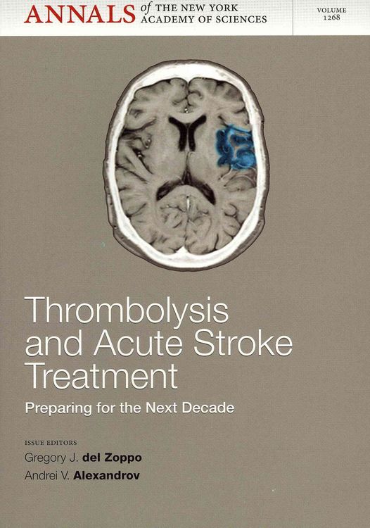Produktbild: Thrombolysis & Acute Stoke