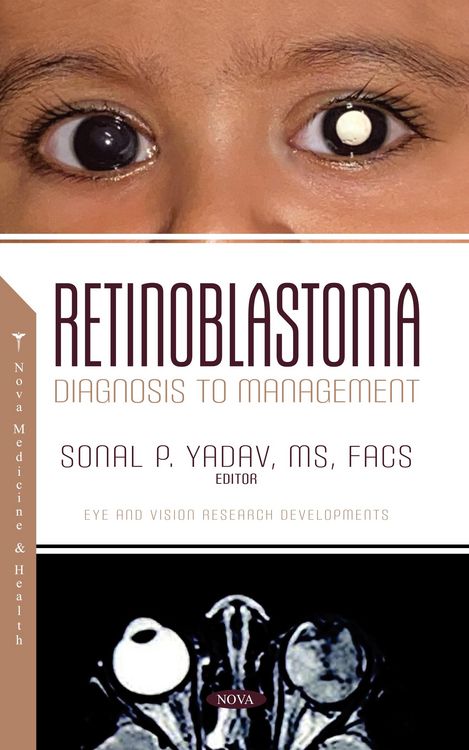 Produktbild: Retinoblastoma: Diagnosis to Management