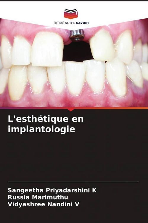 Produktbild: L'esth&eacute;tique en implantologie