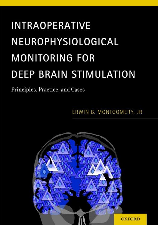 Produktbild: Intraoperative Neurophysiological Monitoring for Deep Brain Stimulation