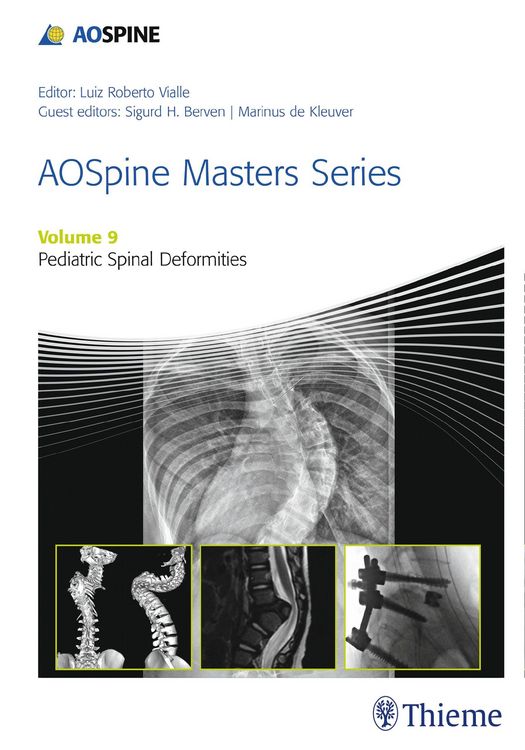Produktbild: AOSpine Masters Series, Volume 9: Pediatric Spinal Deformities