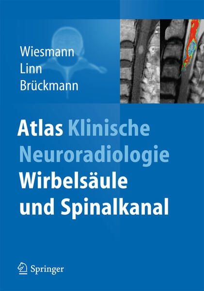 Produktbild: Atlas Klinische Neuroradiologie