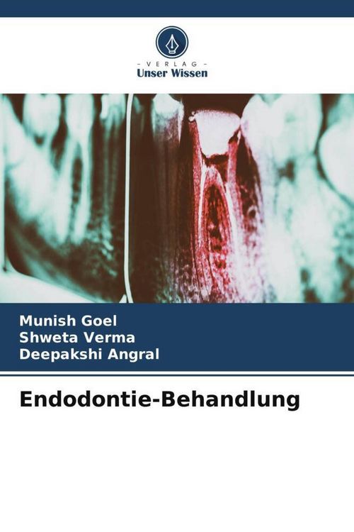 Produktbild: Endodontie-Behandlung