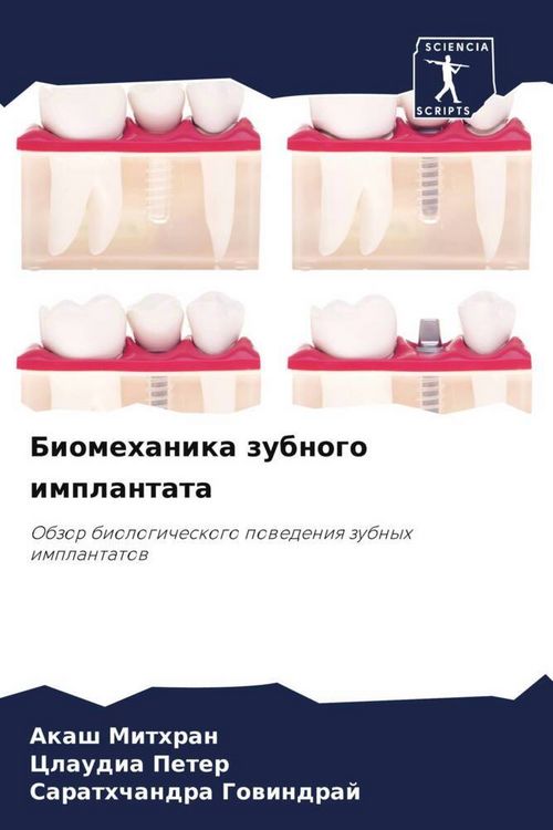 Produktbild: Biomehanika zubnogo implantata