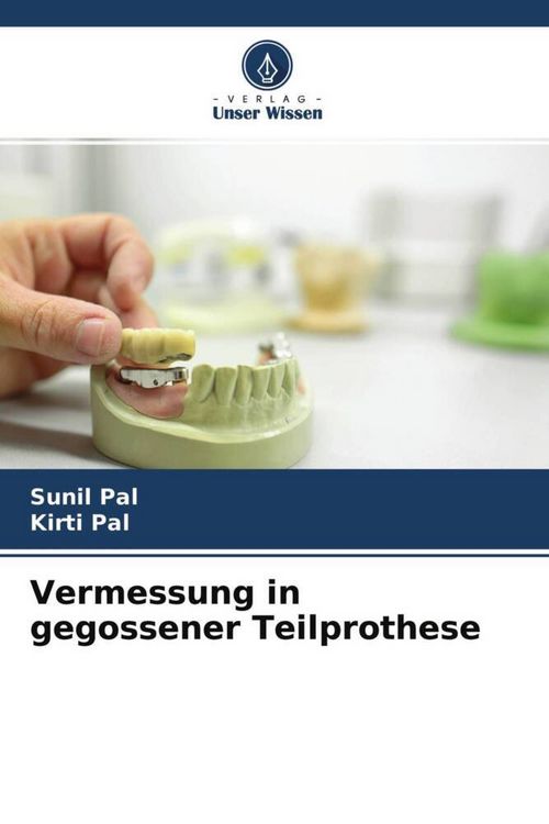 Produktbild: Vermessung in gegossener Teilprothese