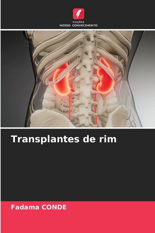 Produktbild: Transplantes de rim