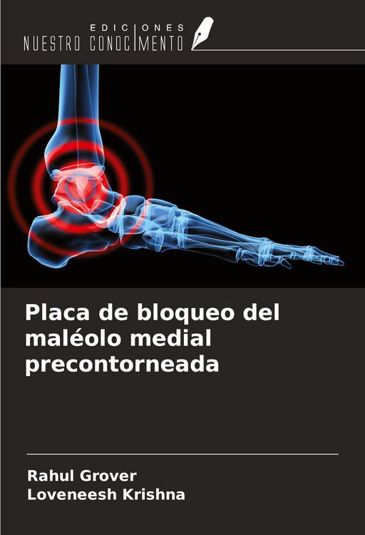 Produktbild: Placa de bloqueo del mal&eacute;olo medial precontorneada