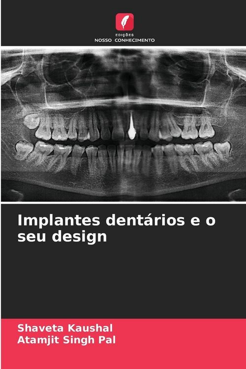 Produktbild: Implantes dent&aacute;rios e o seu design