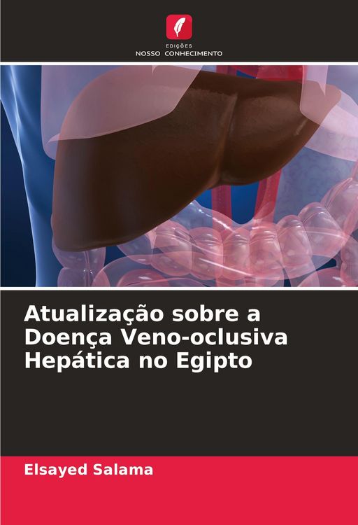 Produktbild: Atualiza&ccedil;&atilde;o sobre a Doen&ccedil;a Veno-oclusiva Hep&aacute;tica no Egipto