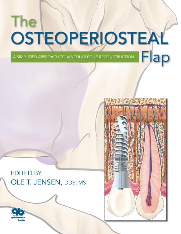 Produktbild: The Osteoperiosteal Flap