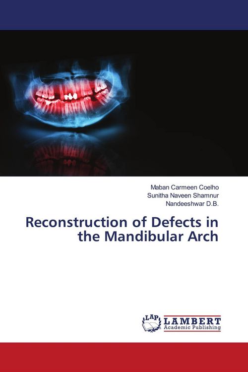 Produktbild: Reconstruction of Defects in the Mandibular Arch