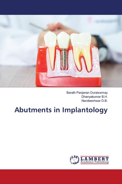Produktbild: Abutments in Implantology