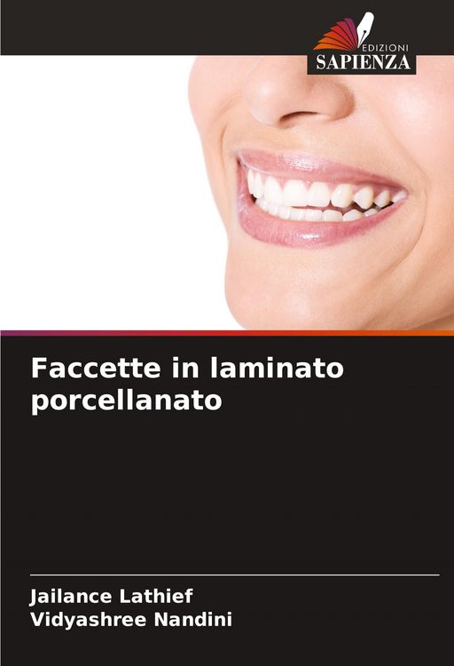 Produktbild: Faccette in laminato porcellanato