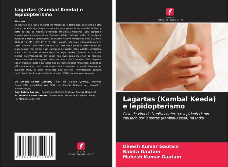 Produktbild: Lagartas (Kambal Keeda) e lepidopterismo