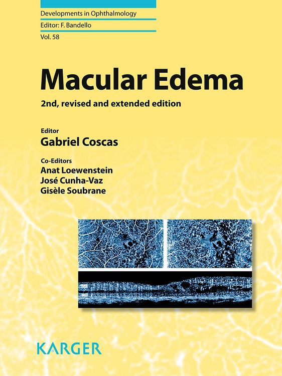 Produktbild: Macular Edema
