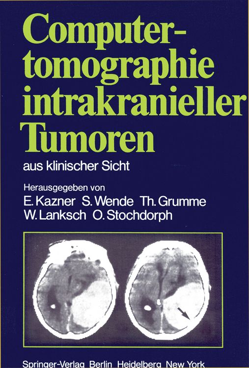 Produktbild: Computertomographie intrakranieller Tumoren aus klinischer Sicht