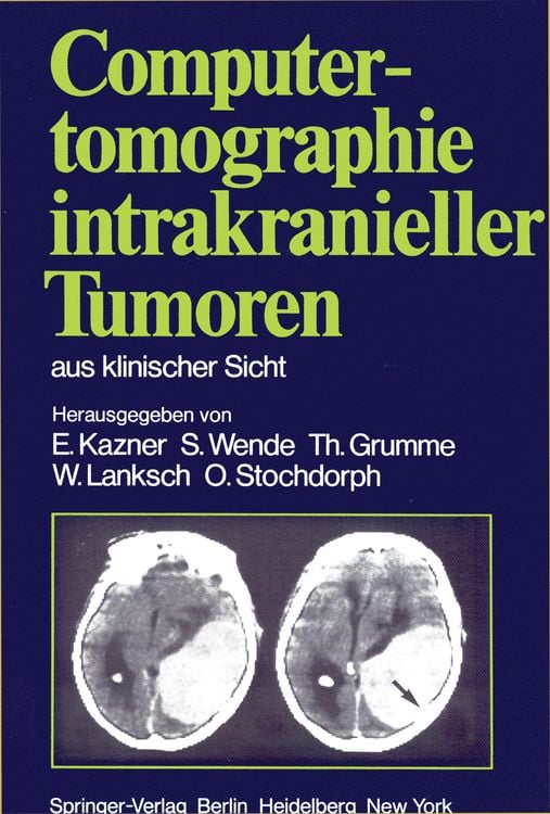 Produktbild: Computertomographie intrakranieller Tumoren aus klinischer Sicht