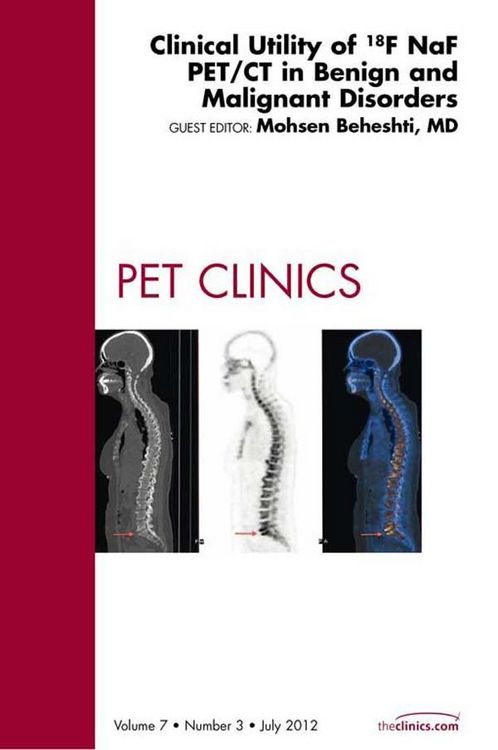 Produktbild: Clinical Utility of 18NaF PET/CT in Benign and Malignant Disorders, An Issue of PET Clinics