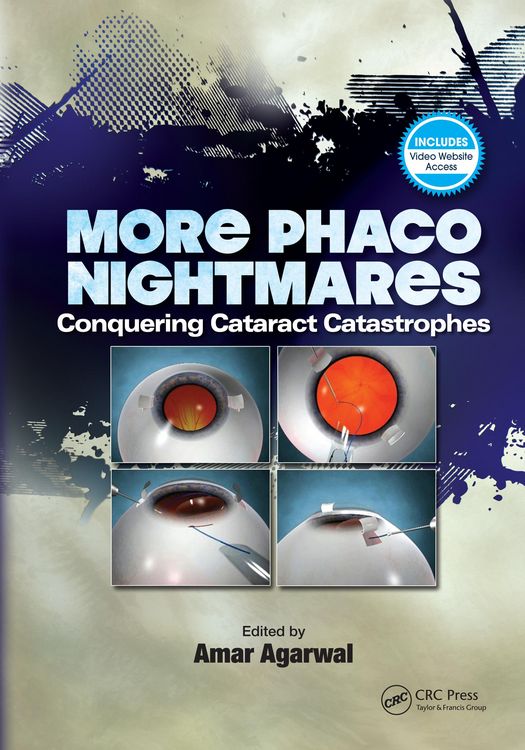 Produktbild: More Phaco Nightmares